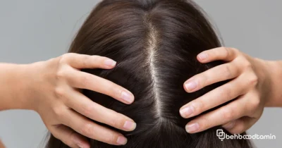کمک به جلوگیری از ریزش مو