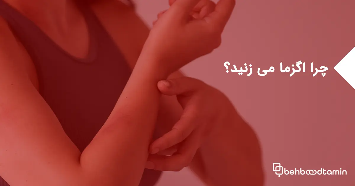 چرا اگزما می زنید؟ دلایل اصلی بروز اگزما