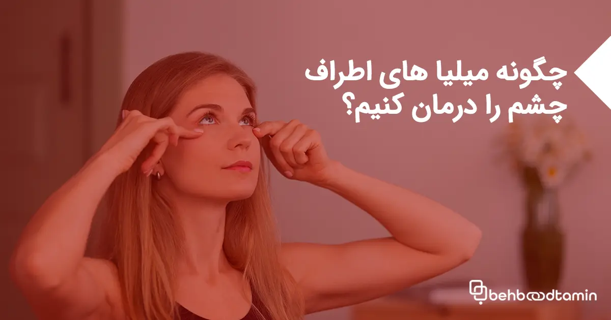 چگونه میلیاهای اطراف چشم را در خانه درمان کنیم؟