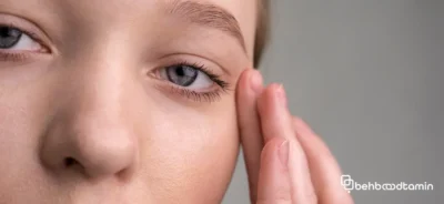 چگونه می توان از میلیا پیشگیری کرد؟