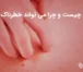 لوپوس چیست و چرا می تواند خطرناک باشد؟