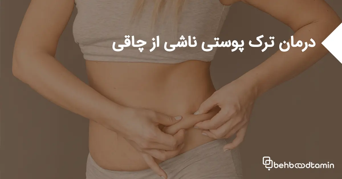 درمان ترک پوستی ناشی از چاقی