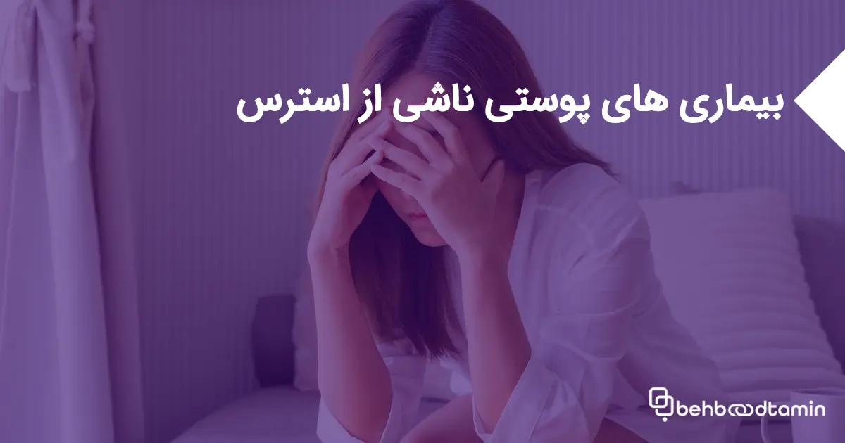 بیماری های پوستی ناشی از استرس