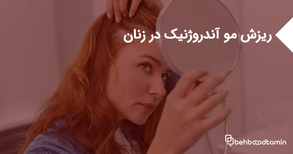 ریزش مو آندروژنیک در زنان