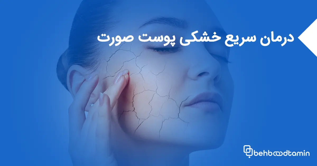 درمان سریع خشکی پوست صورت