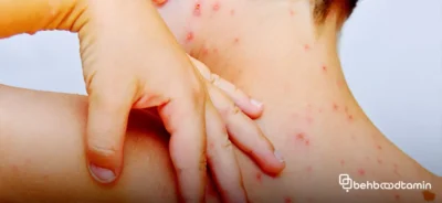 تفاوت های سالک و جوش