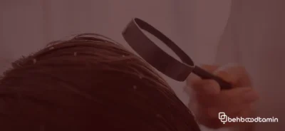 تشخیص دمودکس پوست سر