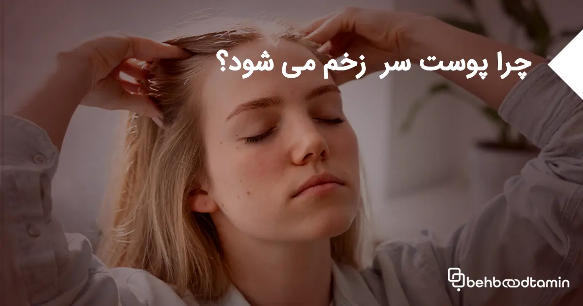 چرا پوست سر زخم می شود؟