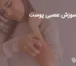 درمان سوزش عصبی پوست
