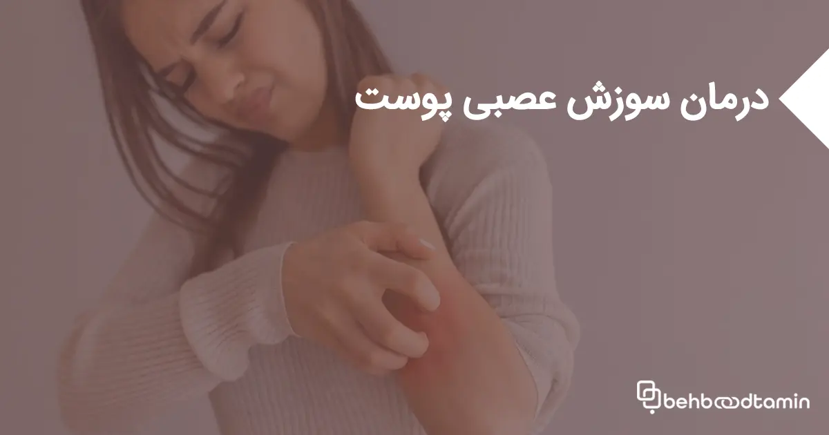 درمان سوزش عصبی پوست