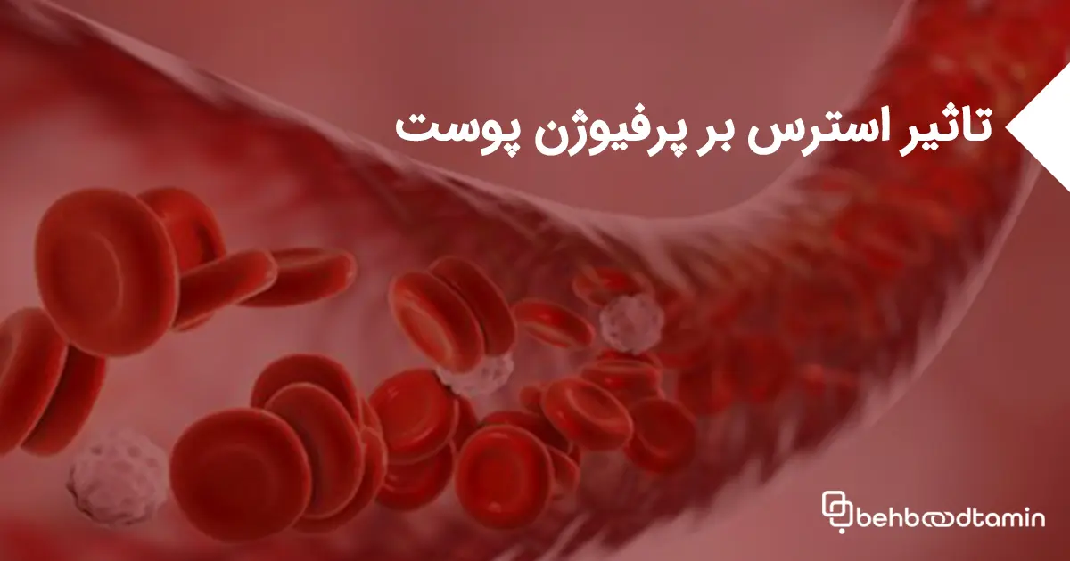 تاثیر استرس بر پرفیوژن پوست