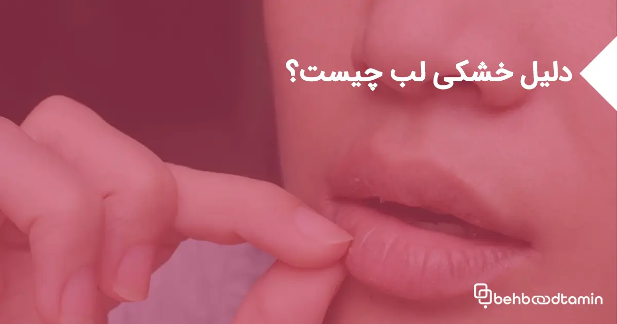 دلیل خشکی لب چیست؟