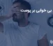 عوارض بی خوابی بر پوست