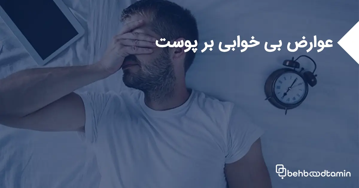 عوارض بی خوابی بر پوست