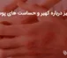 همه چیز درباره کهیر و حساسیت های پوستی