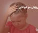 درمان ریزش مو کودکان