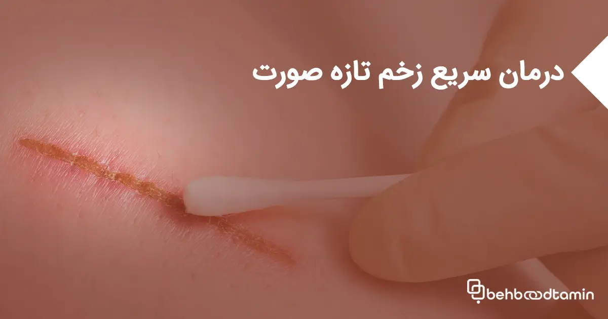 درمان سریع زخم تازه صورت