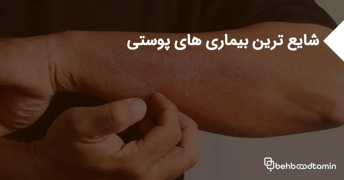 شایع ترین بیماری‌های پوستی