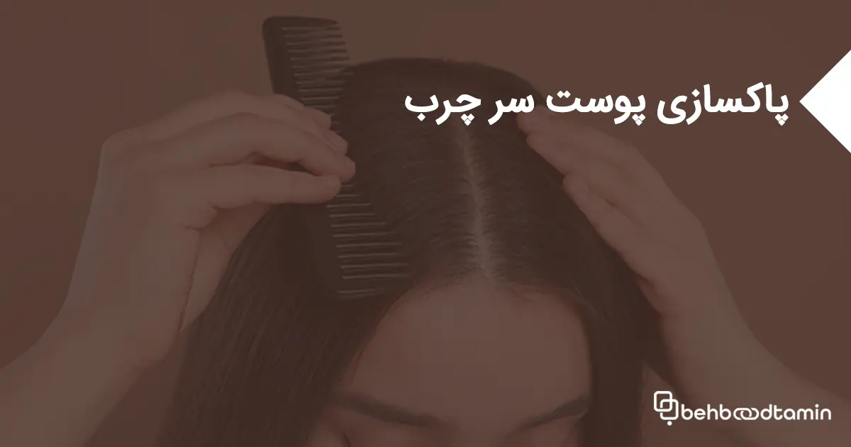 پاکسازی پوست سر چرب