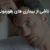 ریزش مو ناشی از بیماری های هورمونی