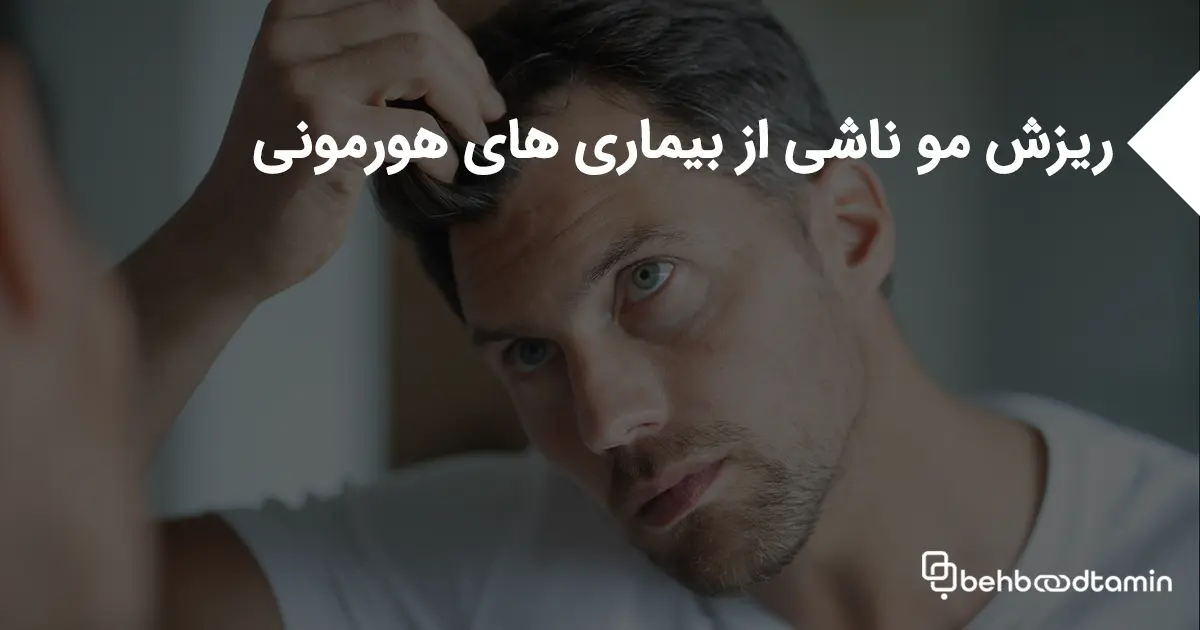 ریزش مو ناشی از بیماری های هورمونی