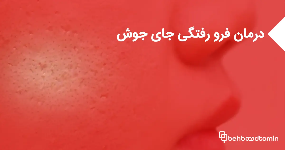 درمان فرورفتگی جای جوش