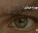 شوره صورت مردان