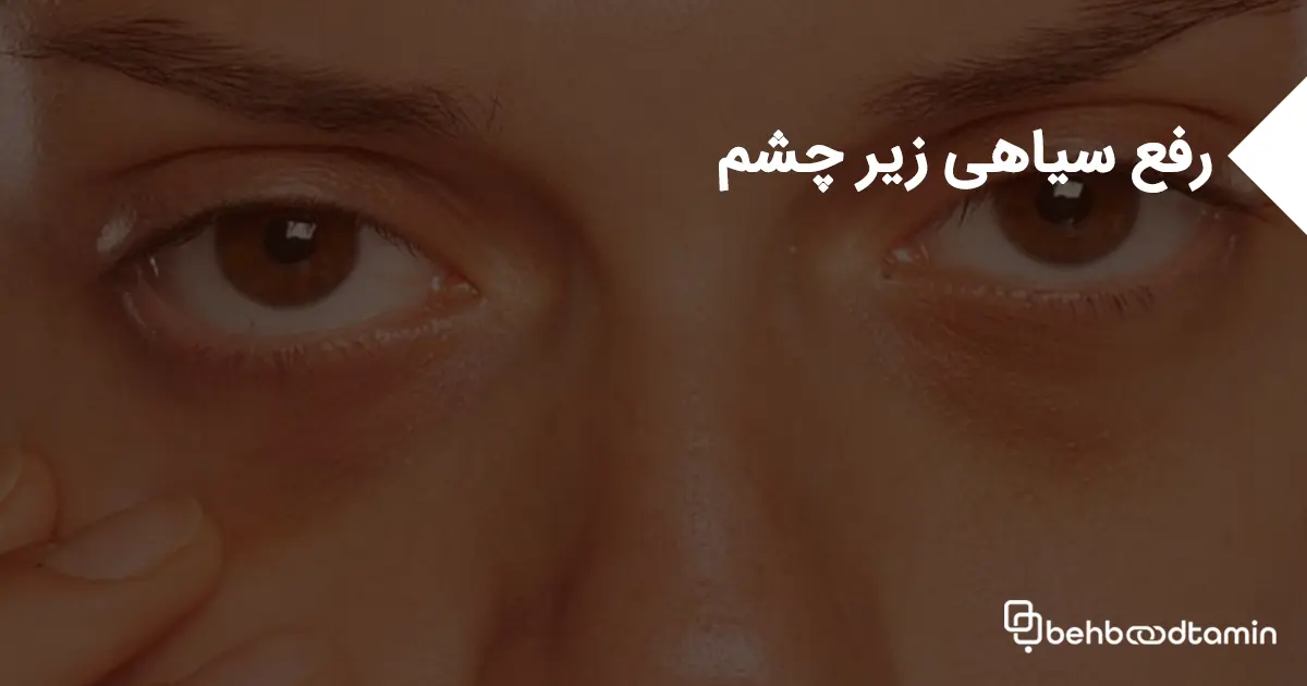 رفع سیاهی زیر چشم