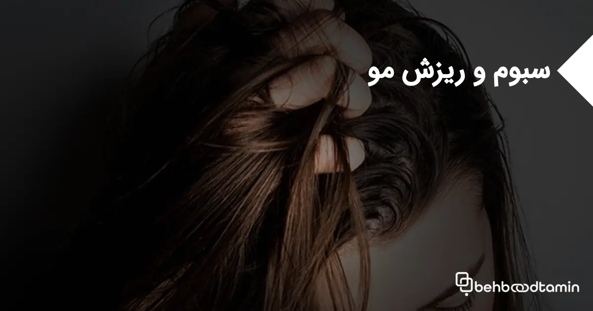 سبوم و ریزش مو