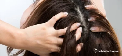 راهکار های پیشگیری از ریزش مو