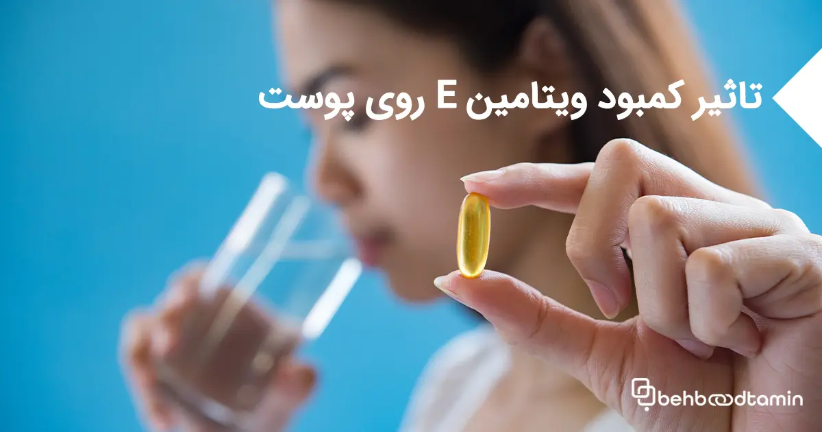 تاثیر کمبود ویتامین ای روی پوست