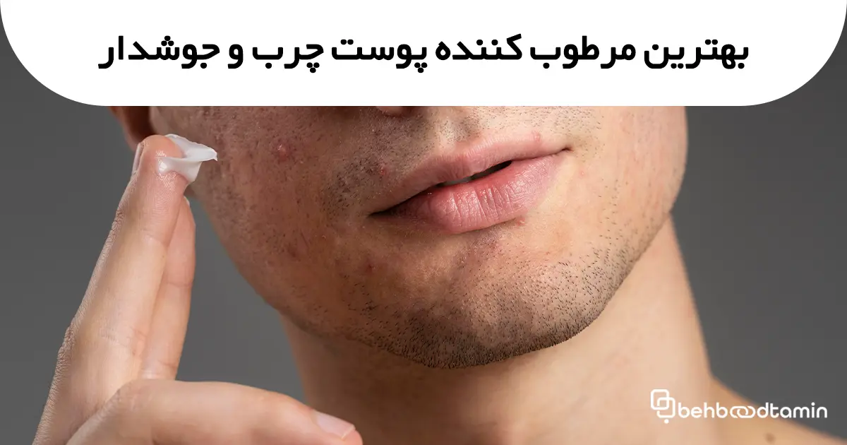 بهترین مرطوب کننده پوست چرب و جوشدار