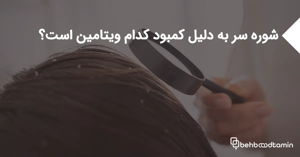 شوره سر به دلیل کمبود کدام ویتامین است؟