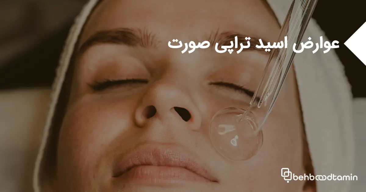 عوارض اسید تراپی صورت