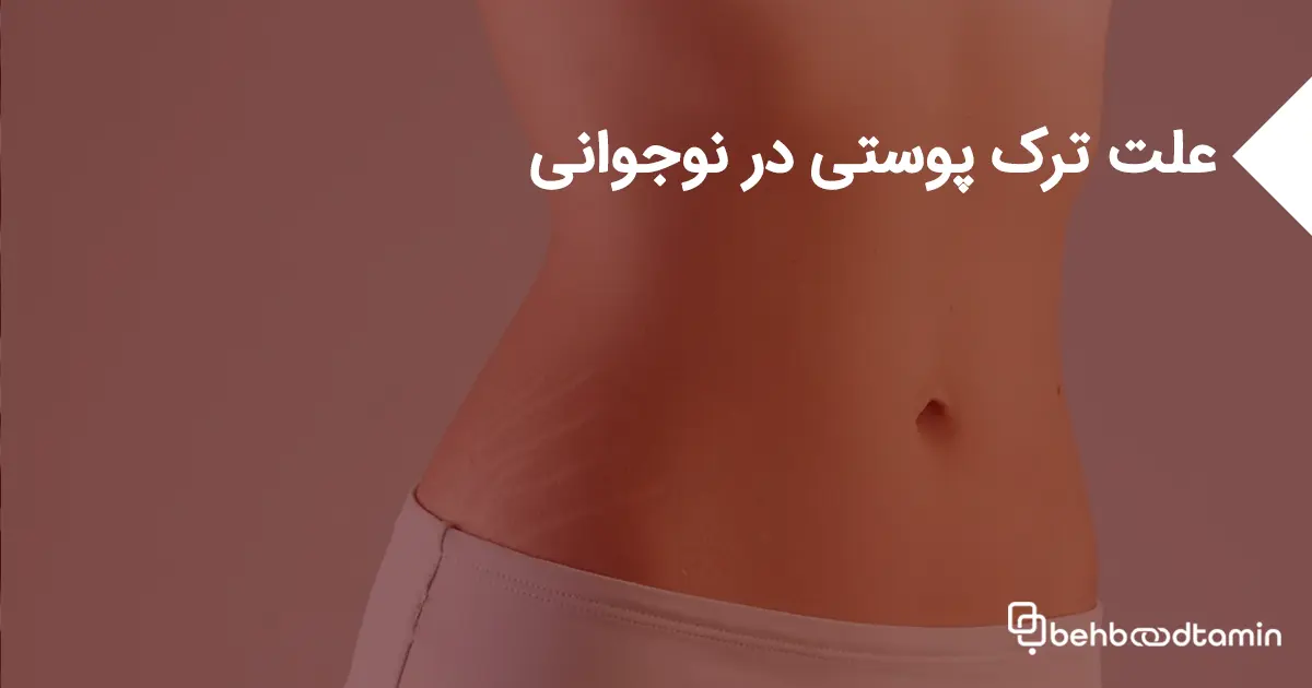 علت ترک پوستی در نوجوانی