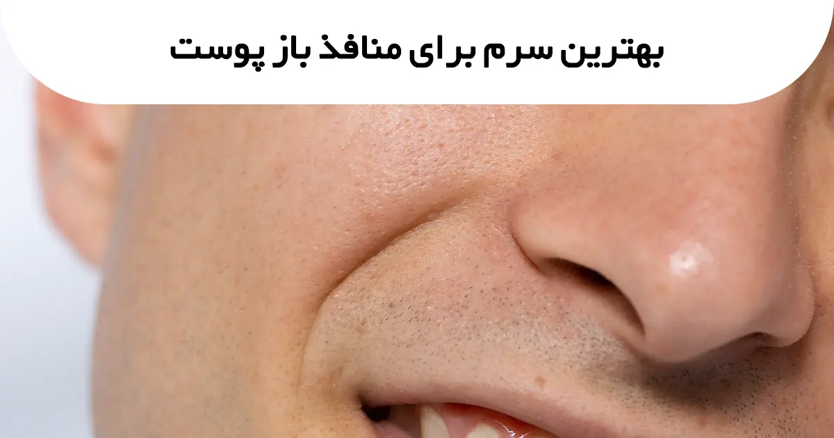 بهترین سرم برای منافذ باز پوست