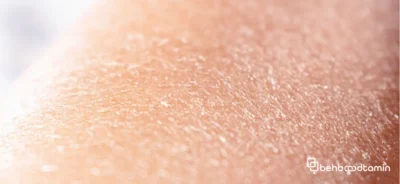 ویژگی‌های مهم یک مرطوب کننده بدن برای پوست خشک