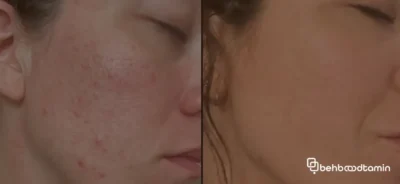  اوره برای چه مشکلاتی مفید است؟