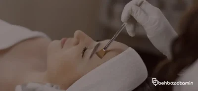 نکات مهم برای کاهش عوارض اسید تراپی برای صورت