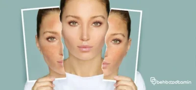 سرم روشن کننده پوست چگونه کار می‌کند؟