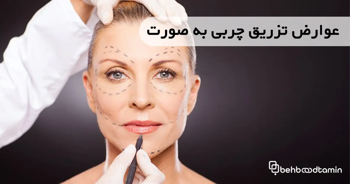 عوارض تزریق چربی به صورت