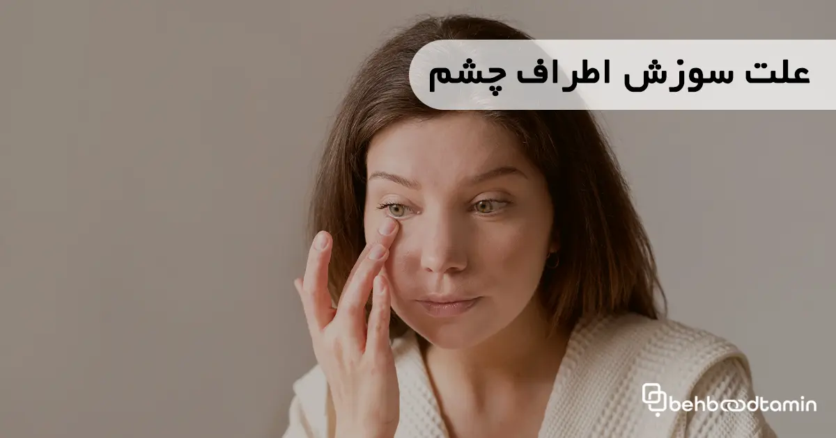 علت سوزش اطراف چشم