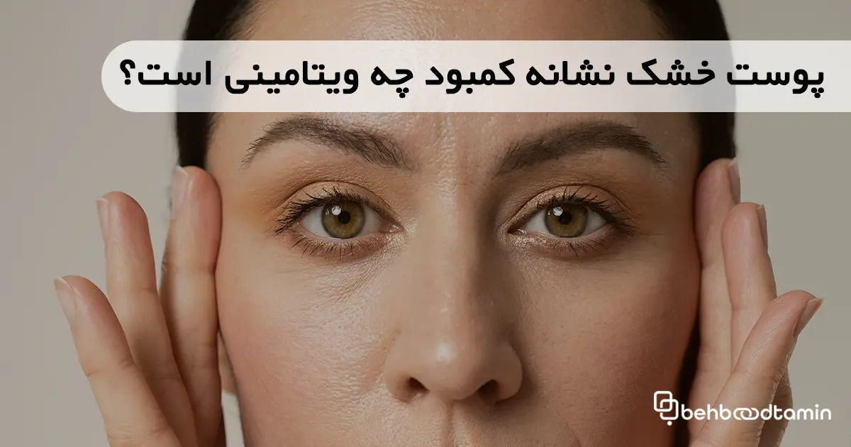 پوست خشک نشانه کمبود چه ویتامینی است؟