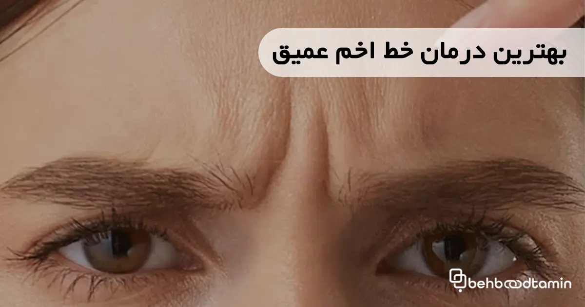 بهترین درمان خط اخم عمیق
