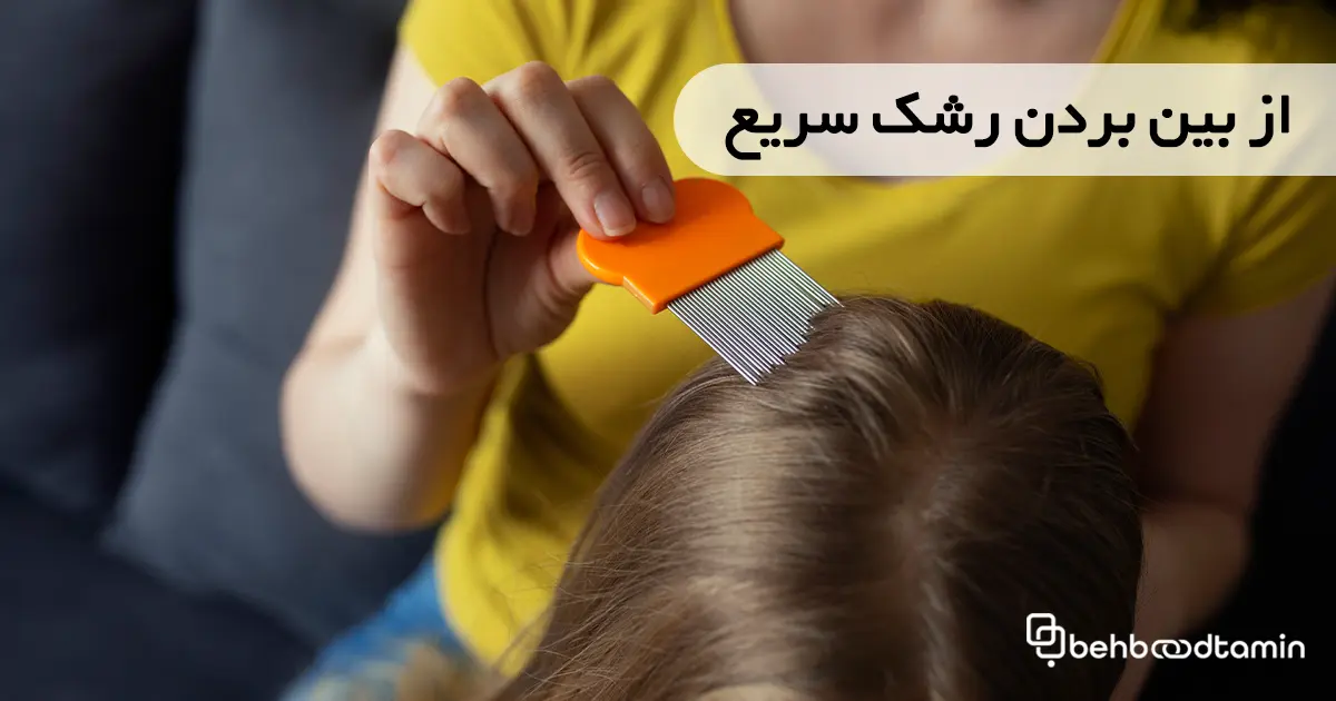 از بین بردن رشک سریع