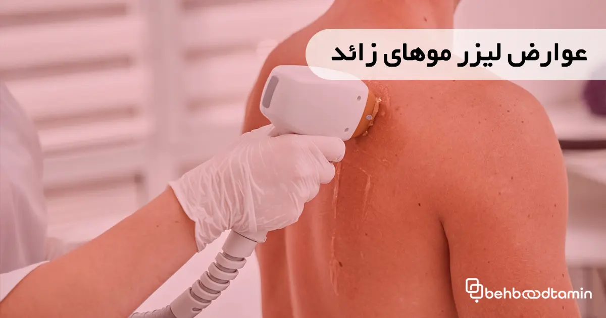 عوارض لیزر موهای زائد