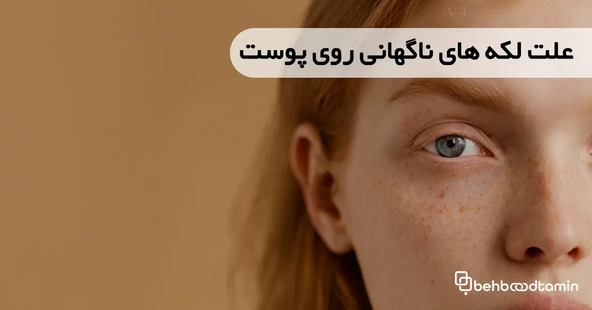 علت لکه‌های ناگهانی روی پوست