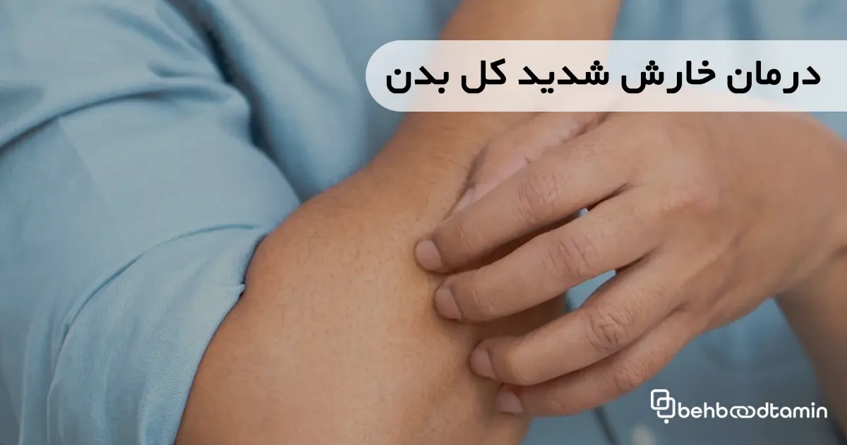 درمان خارش شدید کل بدن