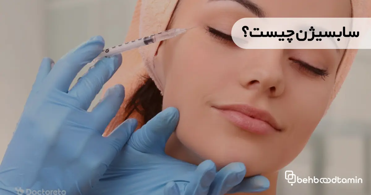 سابسیژن چیست؟