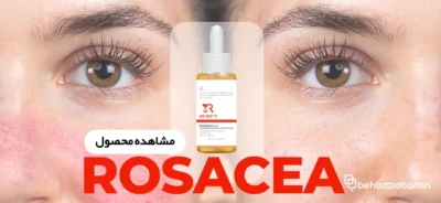 سرم روزاسه دکتر متی 